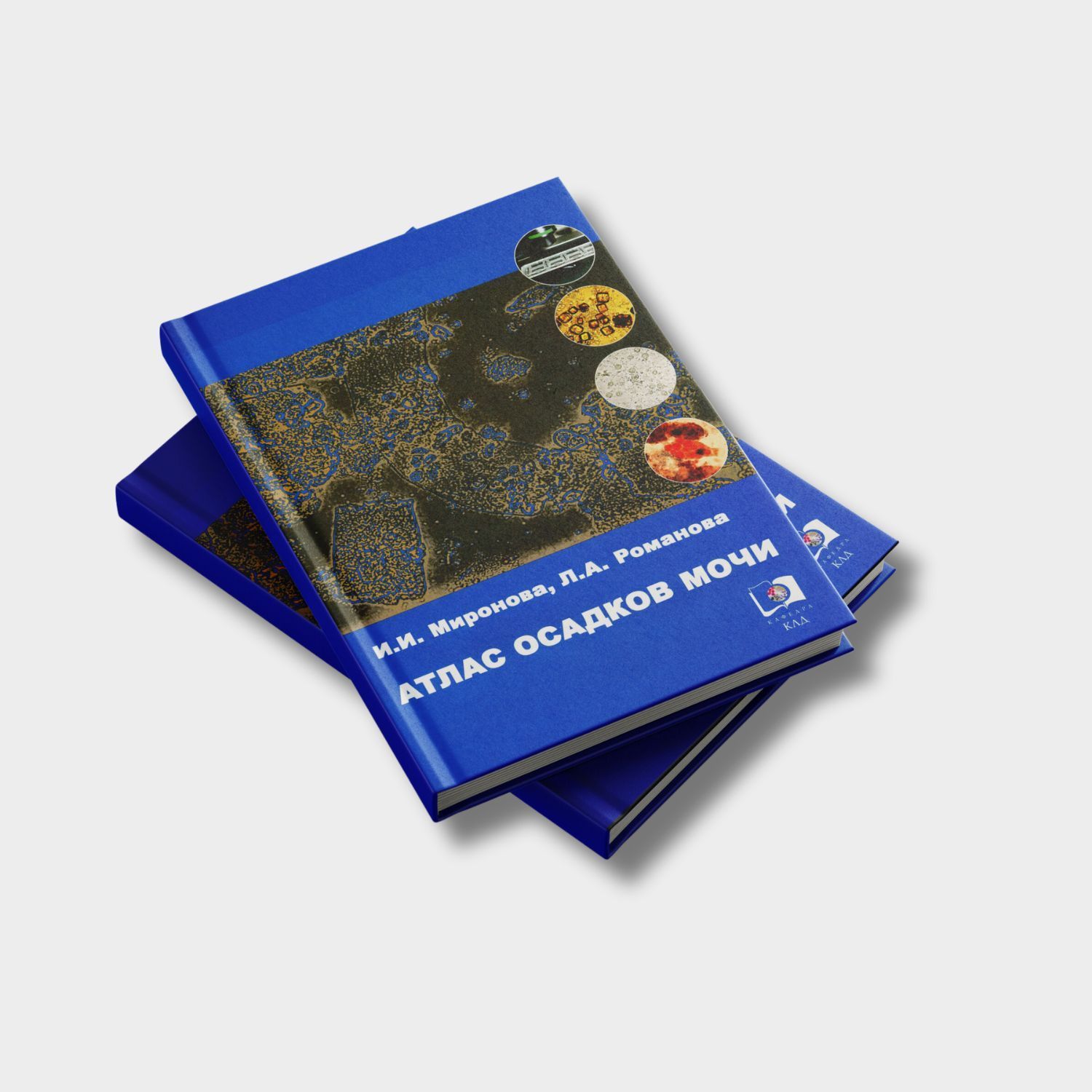 Атлас осадков мочи